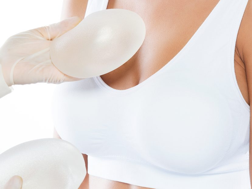 Breast Augmentation