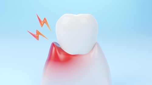 Severe Tooth Pain