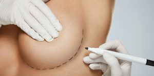 capsular contracture symptoms