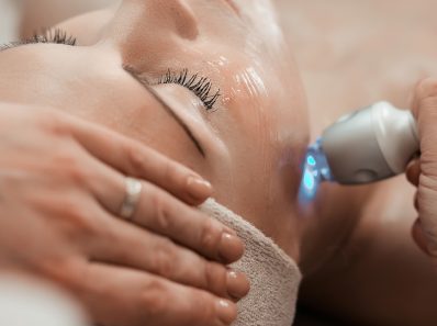 What is a laser facial