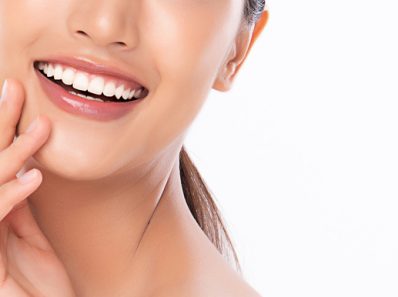 Teeth Whitening After Dental Bonding