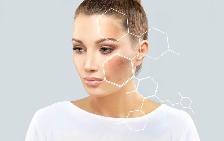 Pigmentation
